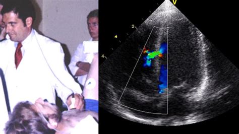 Communicating echocardiography results to patients: a future .